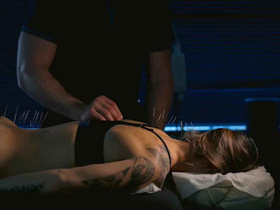San Diego Sports Acupuncture